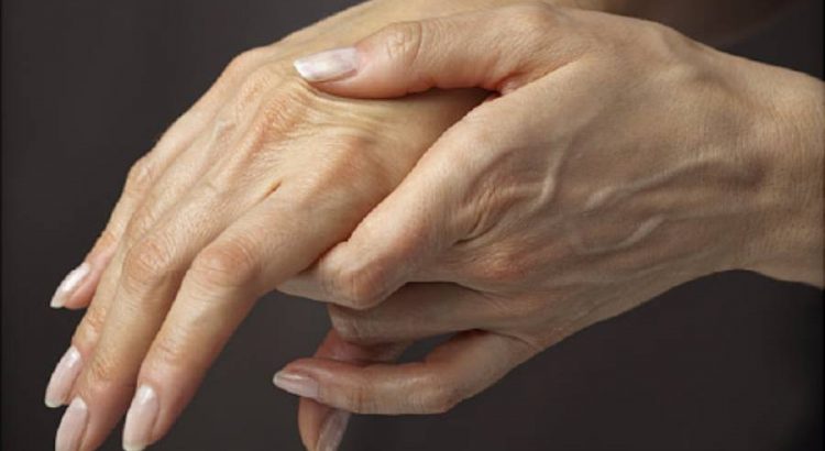 Symptoms of Rheumatoid