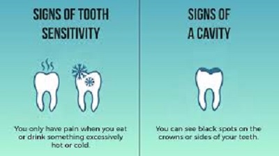 Tooth displaying signs of cavity